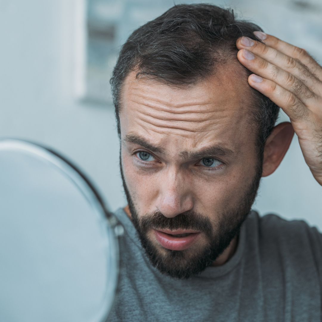 Mens Hair Loss